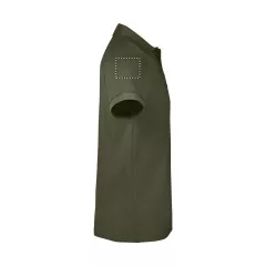ARM RIGHT
